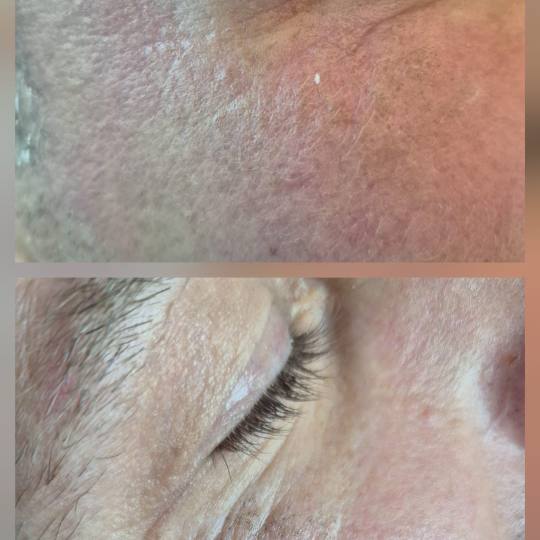 Mila Beauty Centar usluga