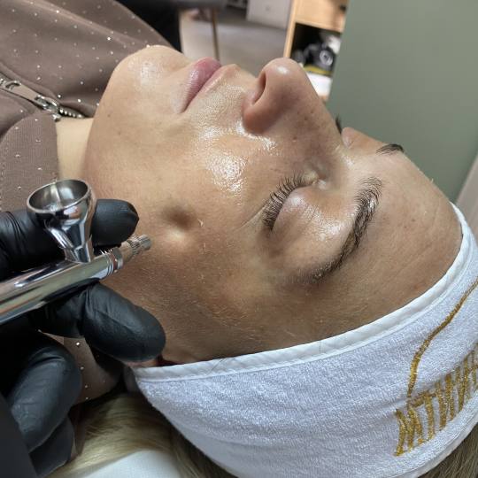 Beauty by Nevena Panić #beograd Tretman lica Winner filer tretman