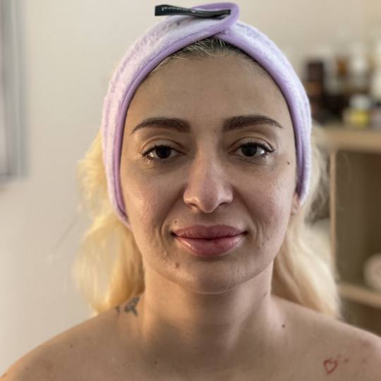 Angelique beauty center usluga