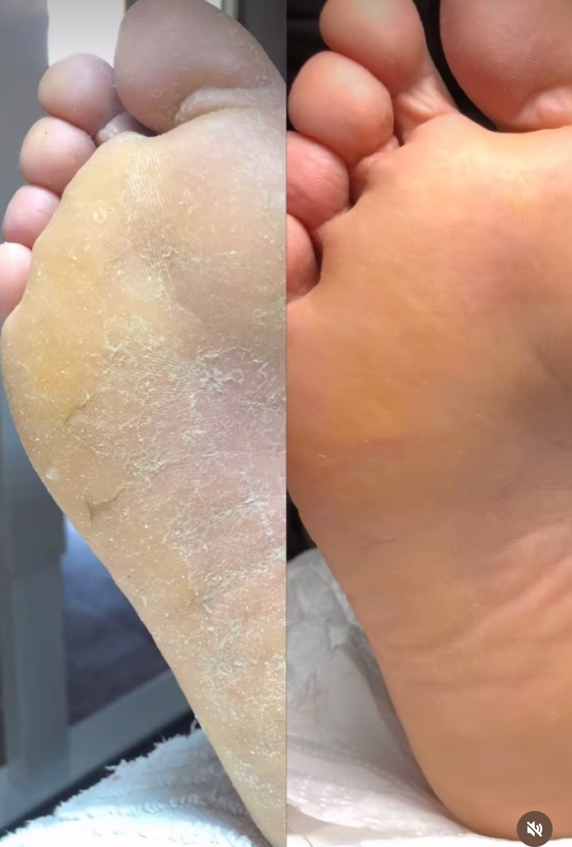 Beauty Hoakina #beograd Estetski pedikir Estetski pedikir - za muškarce