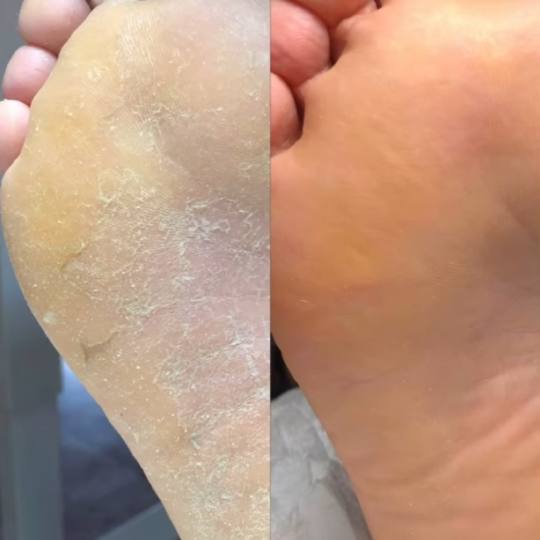 Beauty Hoakina #beograd Estetski pedikir Estetski pedikir - za muškarce