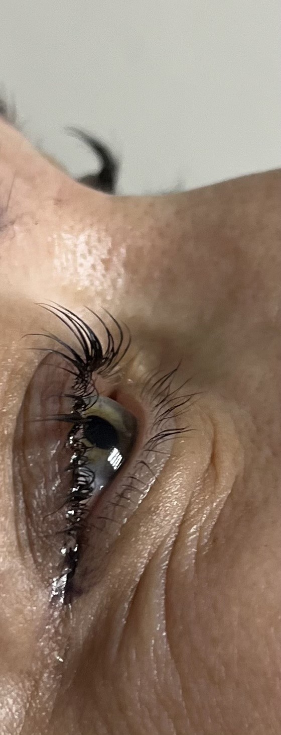 SZFR Igor #beograd Trepavice Lash lift