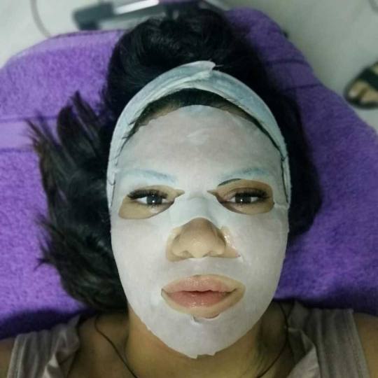 AltaBella Batajnica #beograd Laserski tretmani lica Lasersko podmlađivanje lica