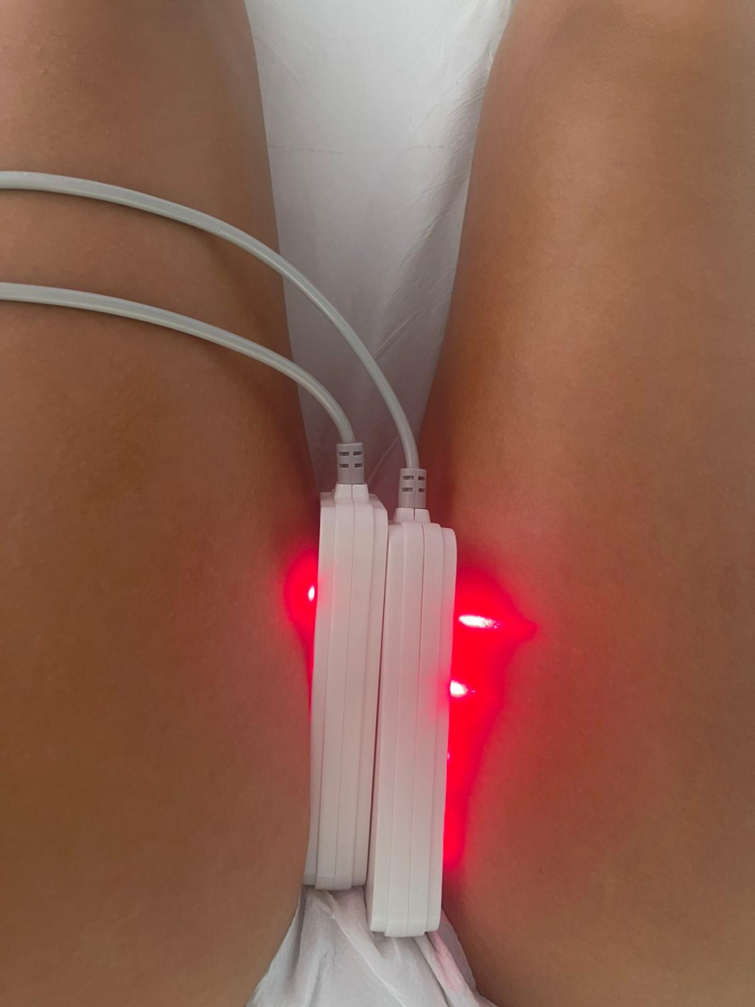 Lipolaser Centar - Matrix021 #novisad Tretmani tela