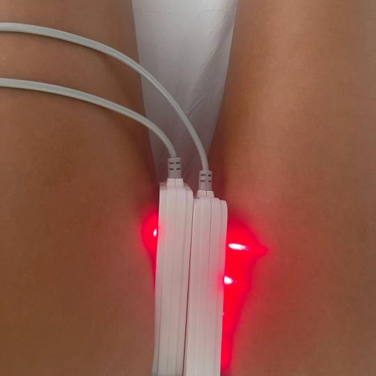 Lipolaser Centar - Matrix021 #novisad Tretmani tela 👉Neinvazivna liposukcija Diodnim Lipolaserimo