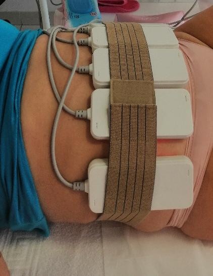 Lipolaser Centar - Matrix021 #novisad Tretmani tela