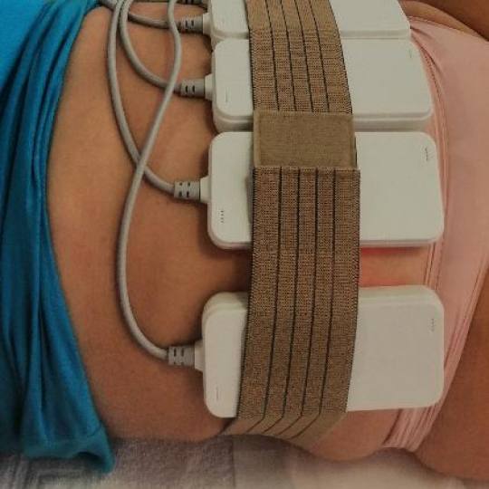 Lipolaser Centar - Matrix021 #novisad Tretmani tela 👉Neinvazivna liposukcija Diodnim Lipolaserimo