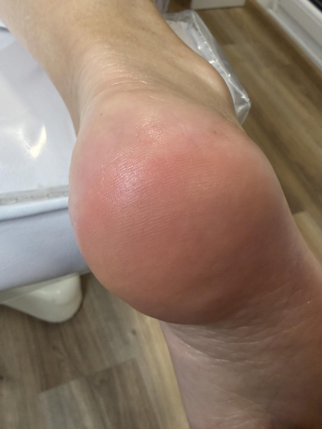 SPA aparatni pedikir - Elle beauty center, Novi Sad Estetski pedikir Nokti Estetski pedikir, Novi Sad, Grbavica, Liman, Adamićevo