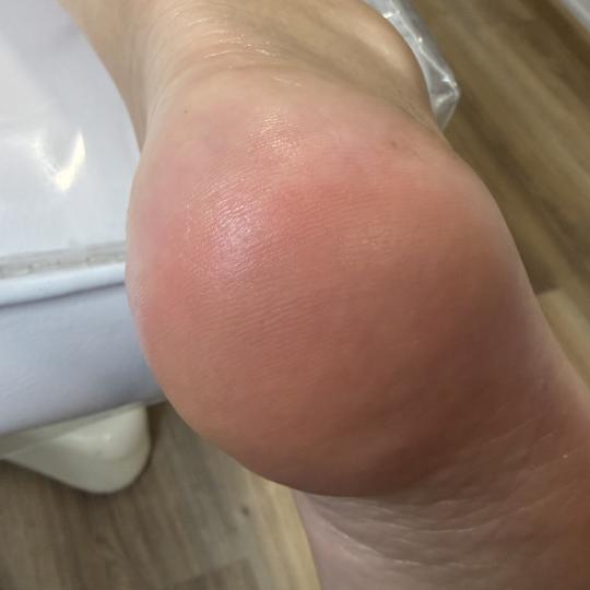 Elle beauty center #novisad Estetski pedikir SPA aparatni pedikir