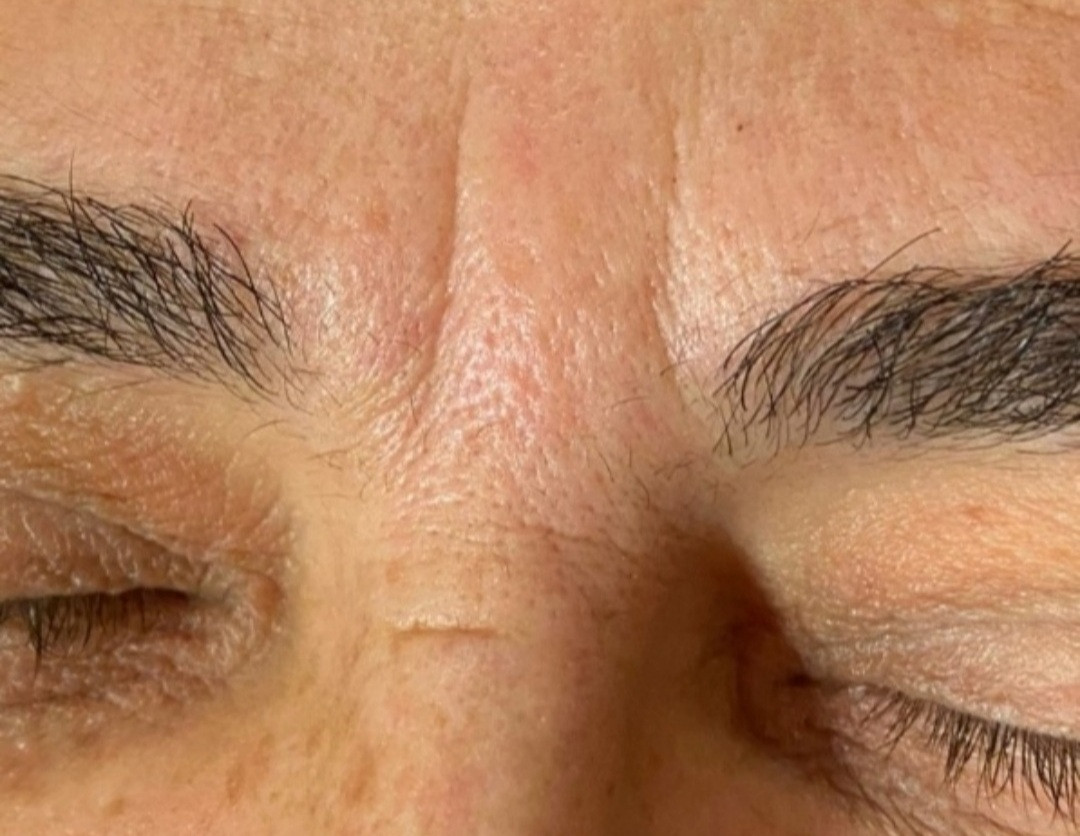 SunBox #beograd Masaža lica Face gym / Face fitness - anti age masaža lica