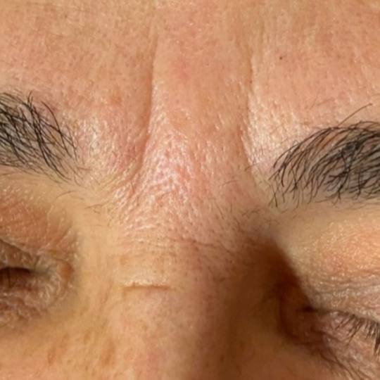 SunBox #beograd Masaža lica Face gym / Face fitness - anti age masaža lica