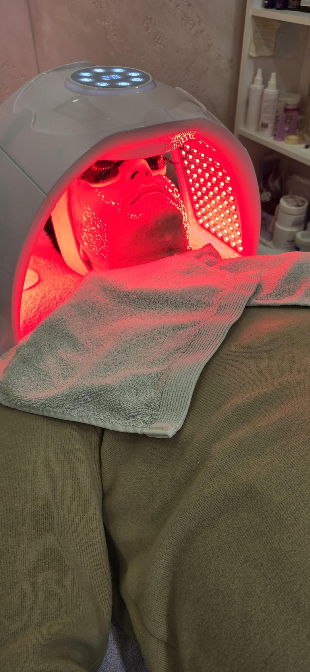 Laser lab by Ceca #novisad Tretman lica Tretman lica LED lampama