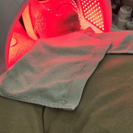 Laser lab by Ceca #novisad Tretman lica Tretman lica LED lampama Tretman se primenjuje kao završnic