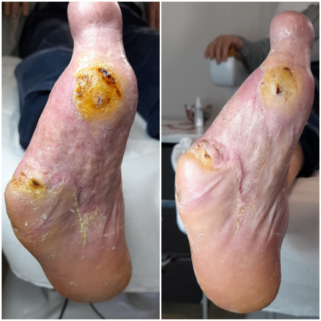 Dr. Prot #beograd Medicinski pedikir Medicinski pedikir - problematičan