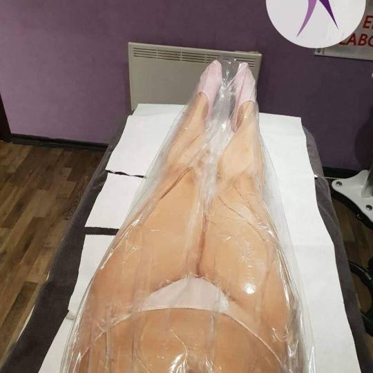 Starmedic #beograd Tretmani za mršavljenje Vacuslim 48