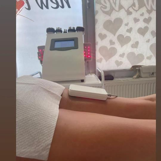 Lipolaser Centar - Matrix021 #novisad Tretmani tela
