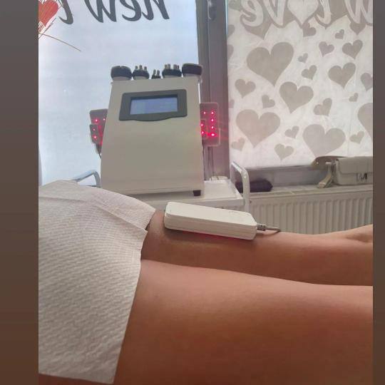 Lipolaser Centar - Matrix021 #novisad Tretmani tela 👉Neinvazivna liposukcija Diodnim Lipolaserimo