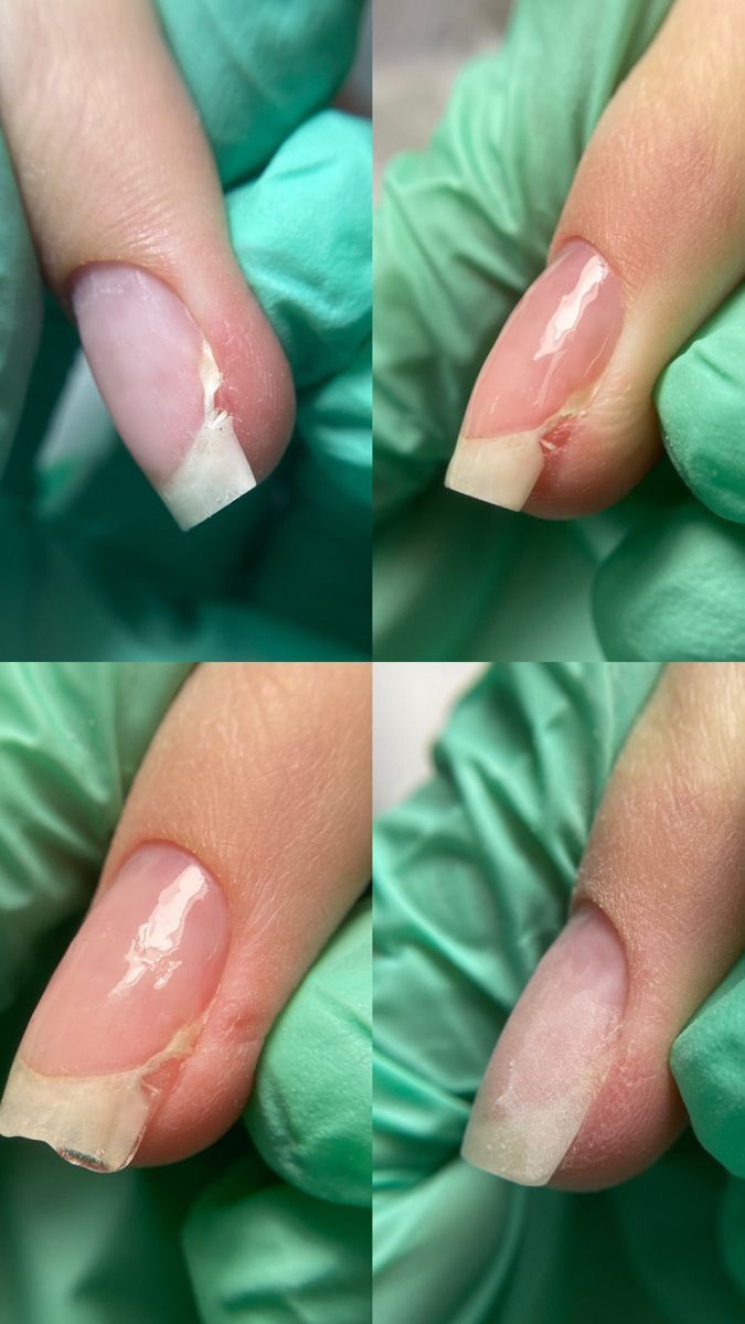 Touch Aesthetic&Medical care #beograd Korekcija noktiju Popravka - 1 nokat