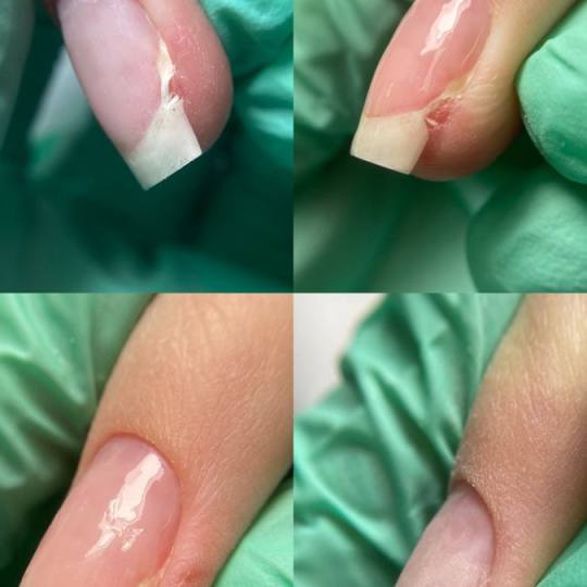 Touch Aesthetic&Medical care #beograd Korekcija noktiju Popravka - 1 nokat