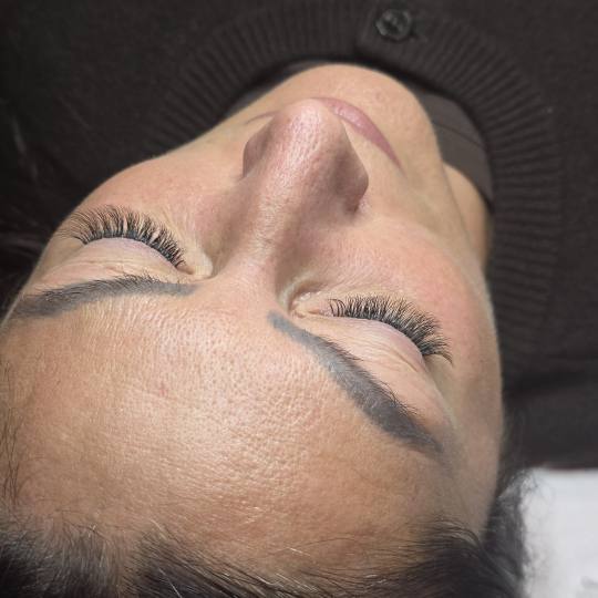 Starmedic #beograd Nadogradnja trepavica Nadogradnja svilenih trepavica - ruski volumen