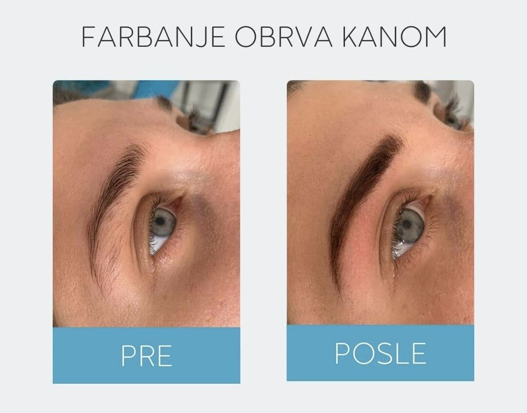 SkyBeauty Zemun (Depilconcept) #beograd
