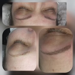 Derma Life #beograd Obrve