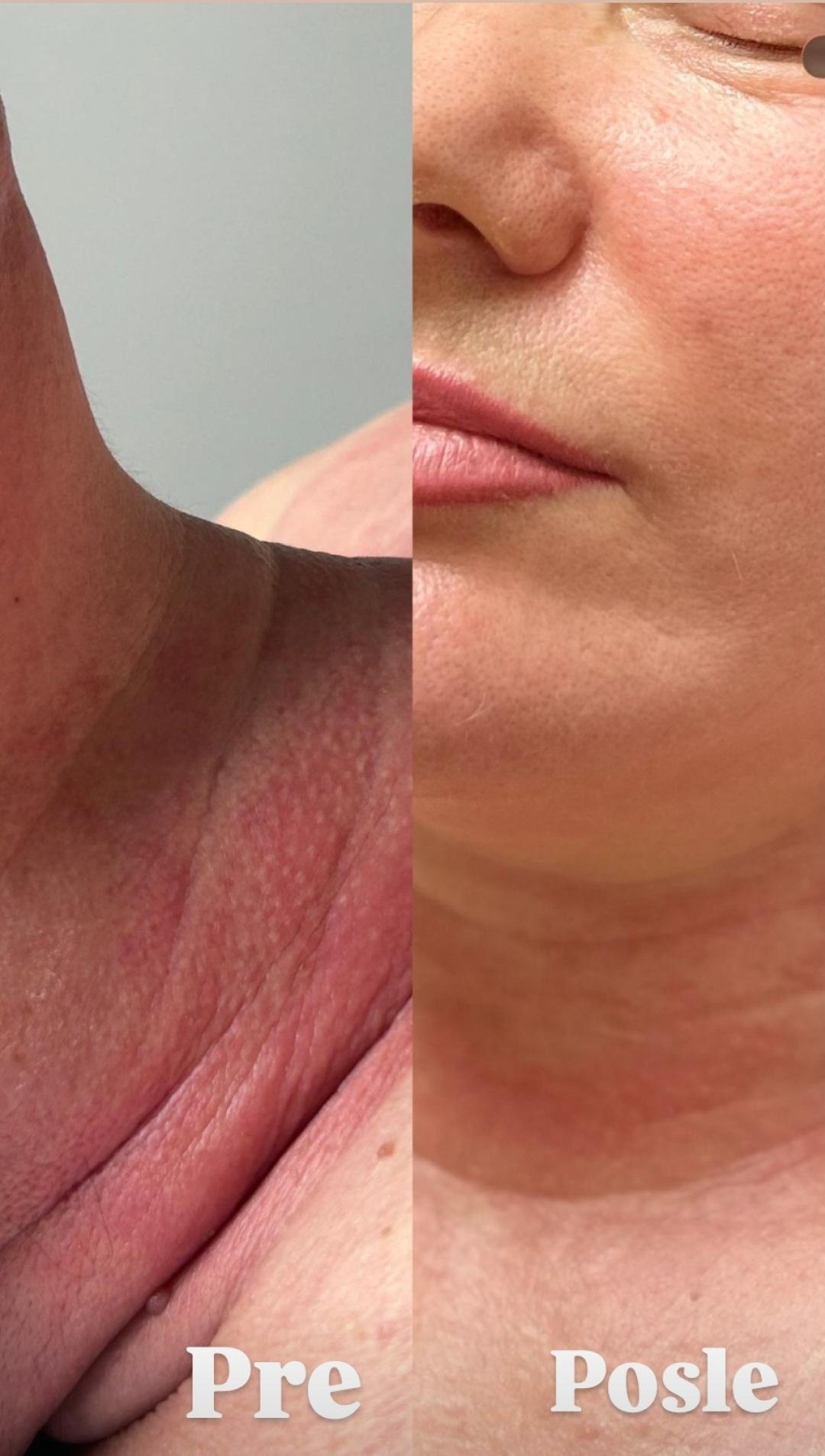 Phyt's tretman - aromalliance anti-age multi-vita - Glow Holistic Studio, Beograd Masaža lica Lice Masaža lica, Beograd, Novi Beograd blokovi, Belville, Savski kej