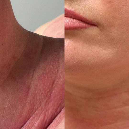 Glow Holistic Studio #beograd Masaža lica Phyt's tretman - aromalliance anti-age multi-vita Ph