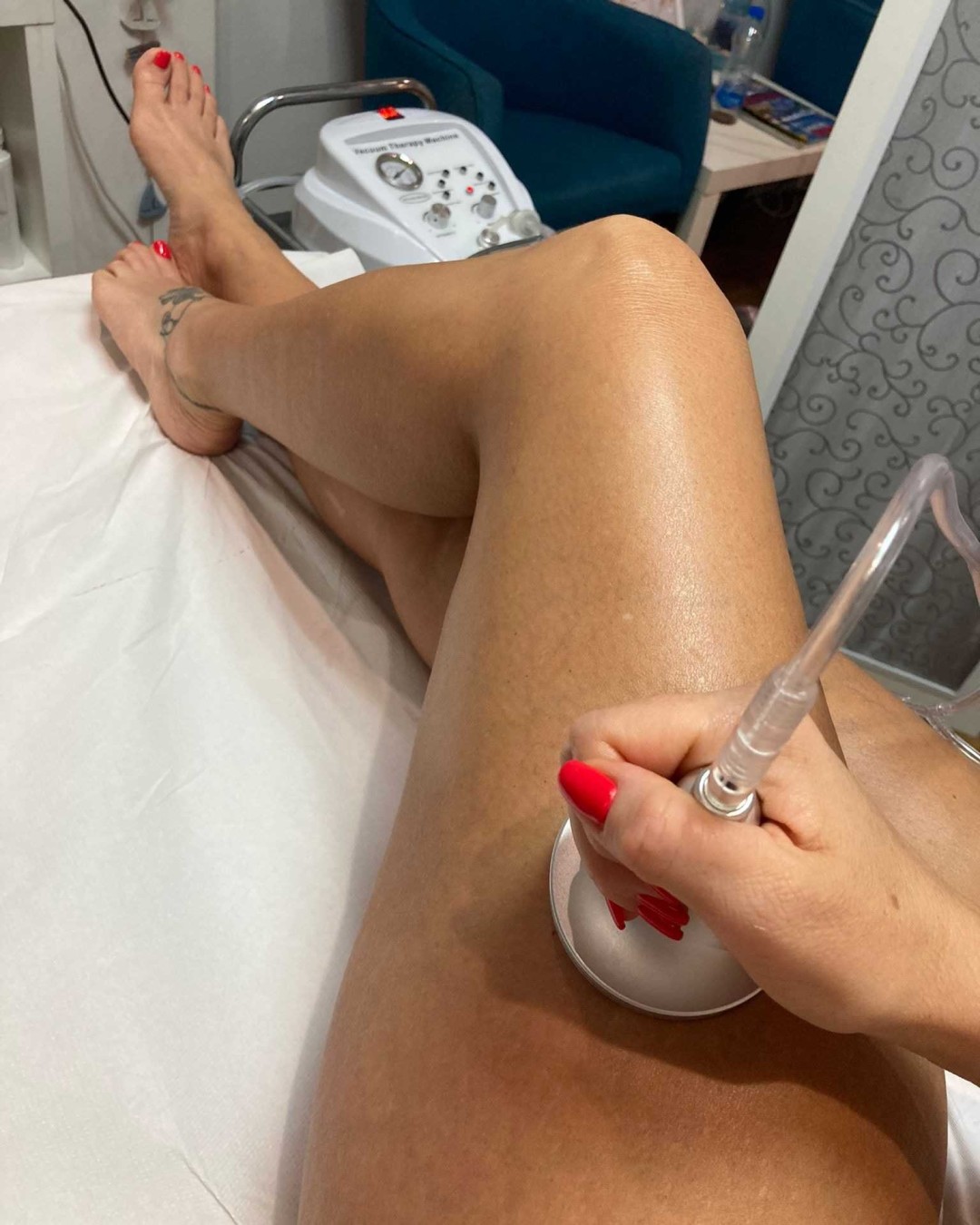 Brankica beauty artist #beograd Mršavljenje Vakum sonda