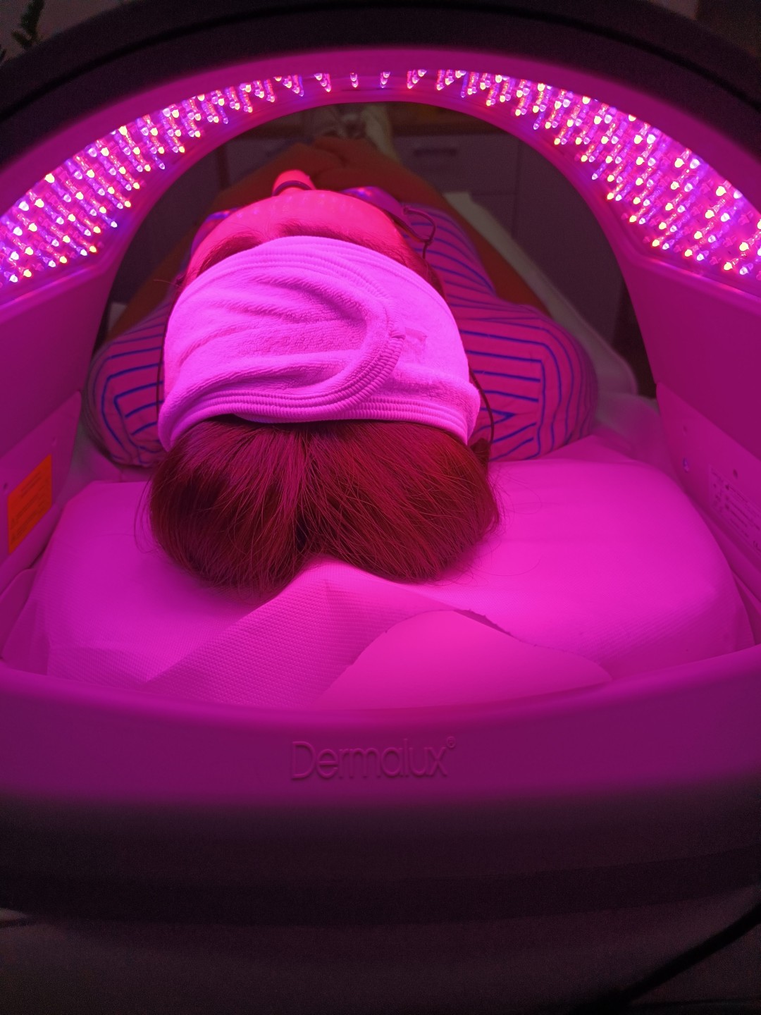 MediBella Aesthetic Dedinje #beograd Tretman lica Derma lux svetlosna terapija