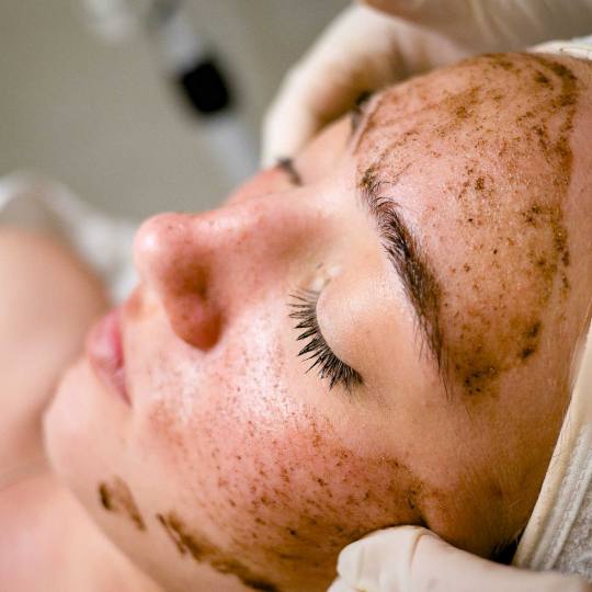 Iva Beauty Lab #beograd Tretman lica Fitopiling lica Fitopiling je terapeutski, biljni piling, koji 
