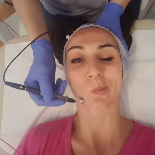 Unna Centar #beograd Tretman lica #neinvazivnamezoterapija Mezoterapija bez igle - anti - aging i re