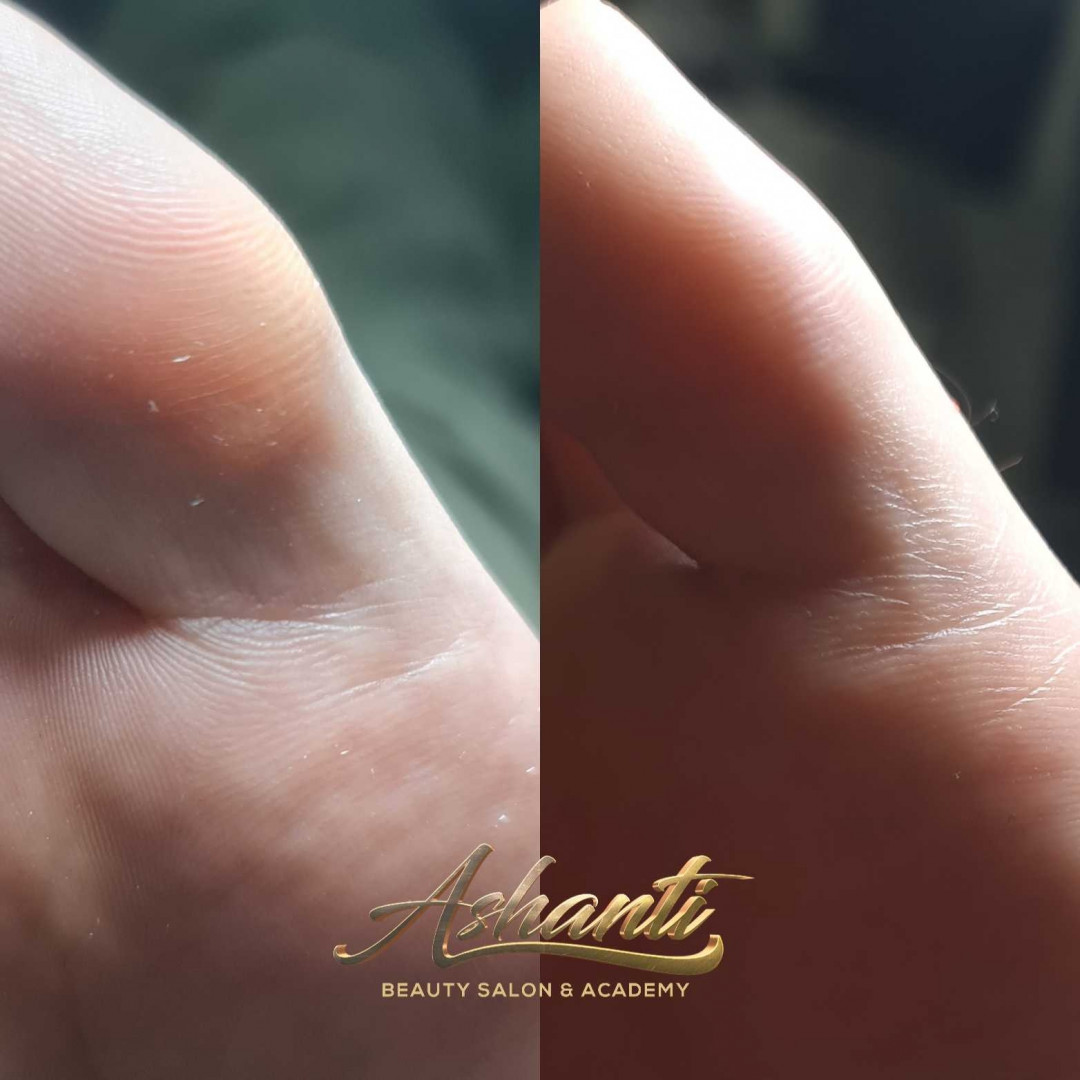 Ruski pedikir + lakiranje noktiju - Ashanti Beauty Salon & Academy, Beograd Estetski pedikir Nokti Estetski pedikir, Beograd, Voždovac