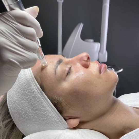 Monika Barta Cosmetics #novisad Dermaroler i dermapen Higijensko čišćenje lica / MDA + dermapen