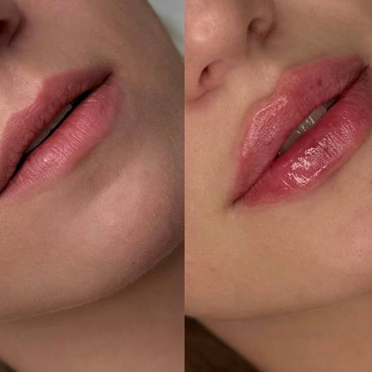 Estetik beauty centar usluga