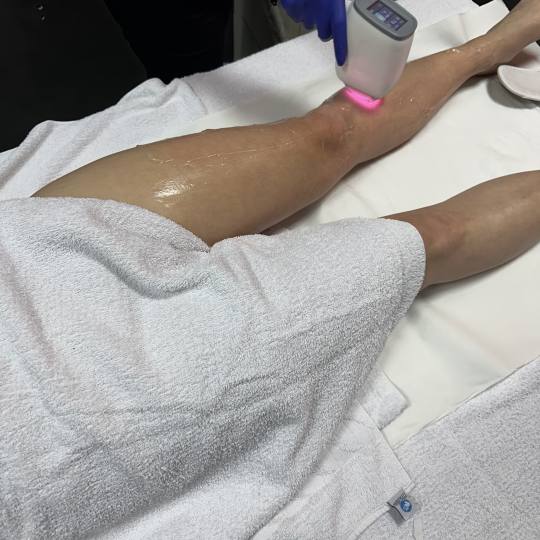 Laser centar Dodoš #beograd Laserska epilacija Laserska epilacija celih nogu - za dame Bezbolan tre