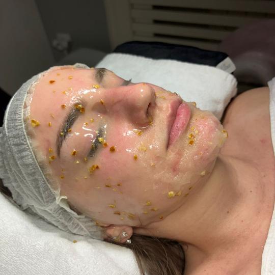 Angels #novisad Tretman lica Bioloski tretman lica sa lux maskom Illuminating orange