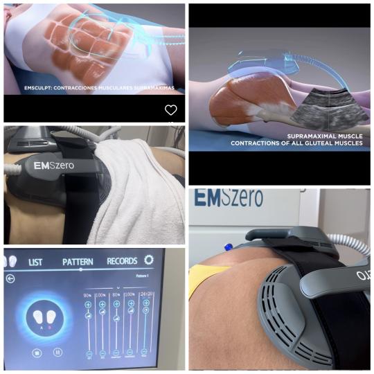 Belle Ana #beograd Tretmani tela EMS tretman - 2 regije