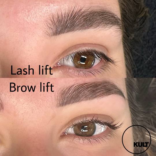 Kult #beograd Obrve Brow lift + botox