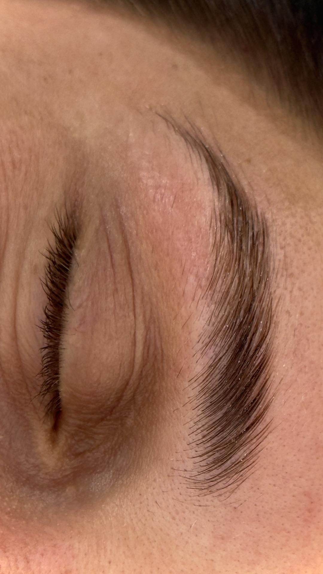 Brow lift - Lola esthetic center, Beograd Obrve Lice Obrve, Beograd, Novi Beograd blokovi, Belville, Savski kej
