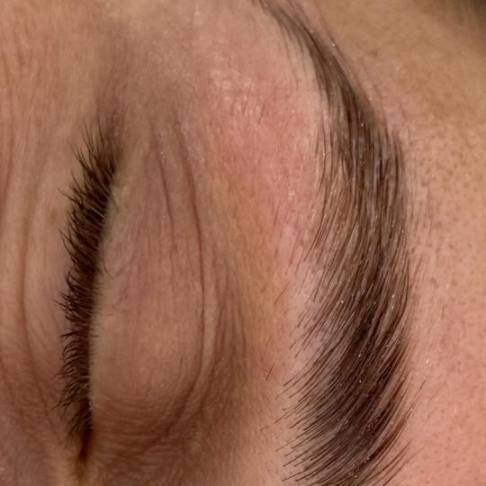 Lola esthetic center #beograd Obrve Brow lift