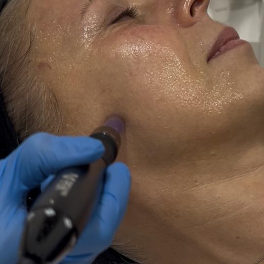 Sandra estetik studio usluga
