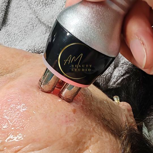 AM BEAUTY STUDIO #odzaci Tretman lica Radiotalasni lifting lica