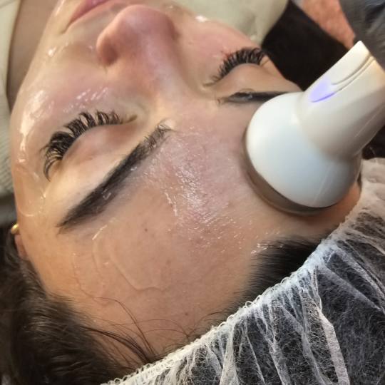 Esthetique Privé #beograd Tretman lica Hydrafacial tretman lica + čišćenje lica