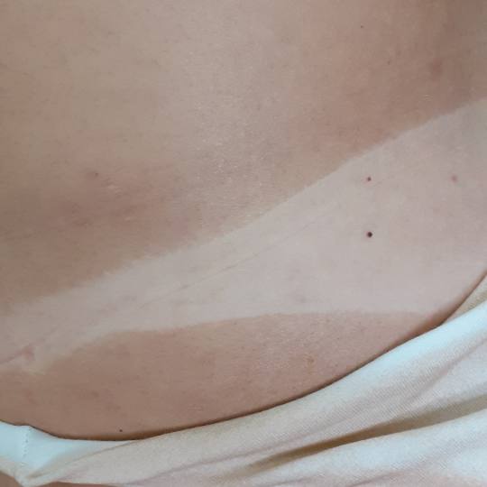 Sana Beauty & Nutrition #beograd Air brush potamnjivanje kože Airbrush Najzdraviji način za tamnje