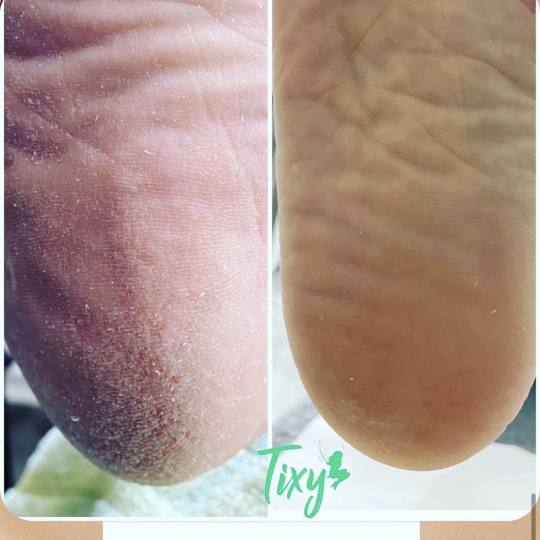 Tixy - Veternik #novisad Estetski pedikir Estetski pedikir Estetski pedikir sadrži uslugu uklanjanj