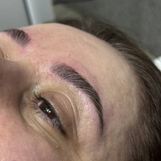 Avangard'S #krusevac Trepavice Brow lift