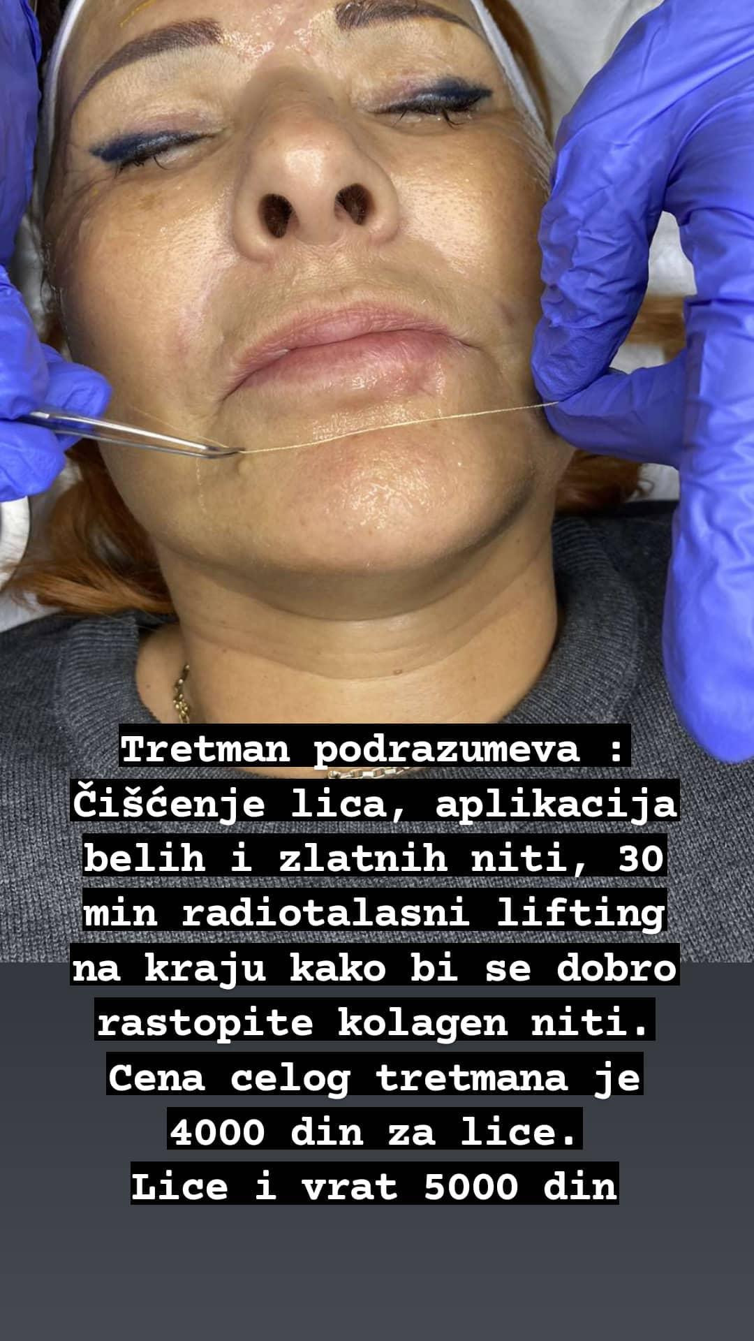 Kolagen niti - lice + vrat - Ceragem Relax, Kruševac Tretman lica Lice Tretman lica, Kruševac, Centar