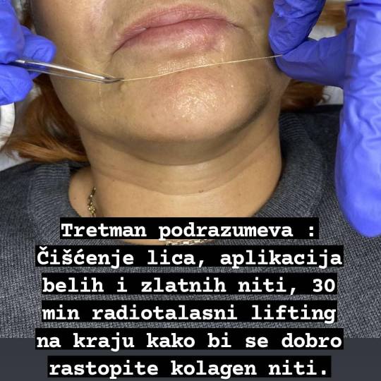 Ceragem Relax #krusevac Tretman lica Kolagen niti - lice + vrat