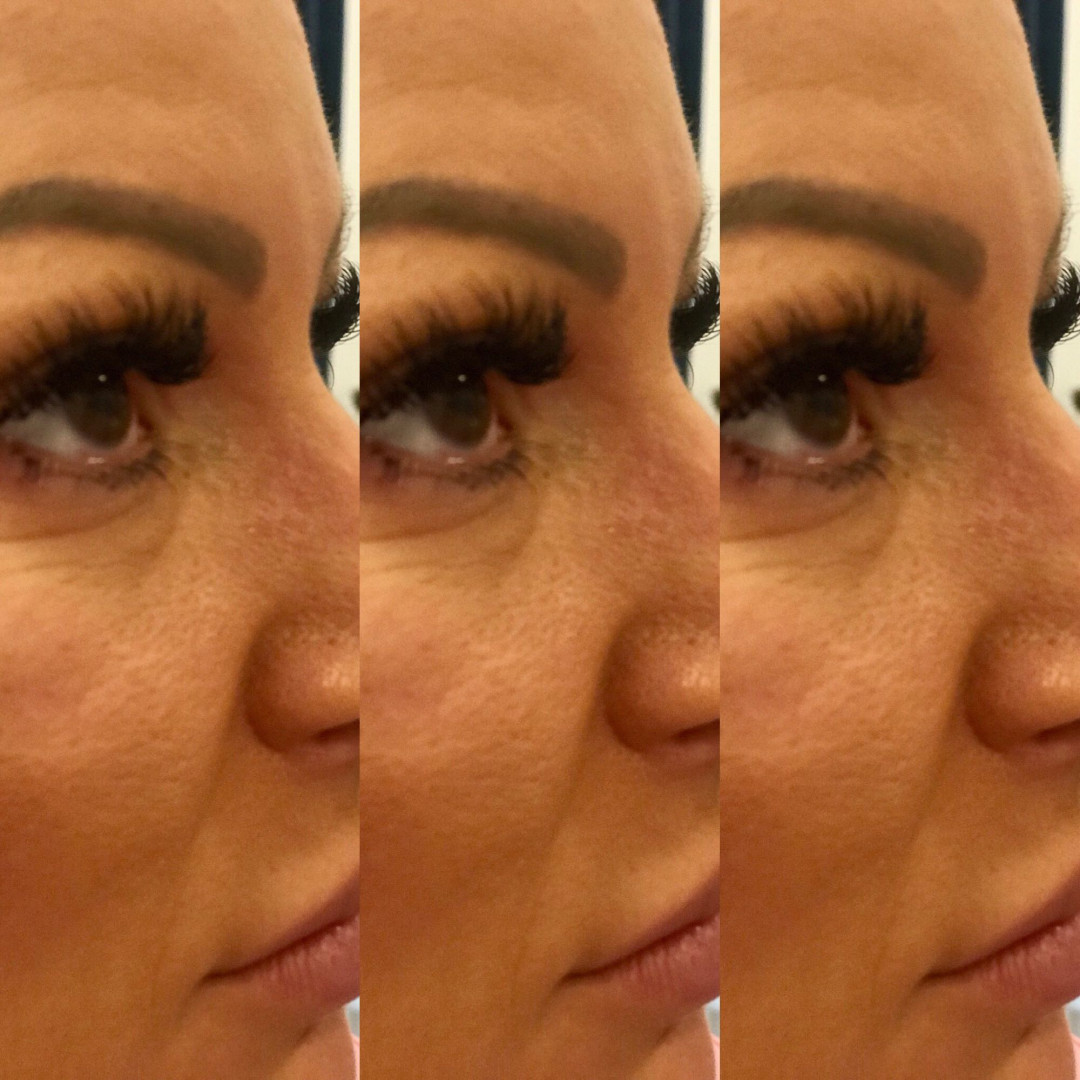Estetic star by Maya #beograd